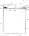 Fig. 01 - Top-fill, reclosable stand-up package with slider device and tamper-evident structure and method of manufacturing same