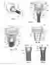 Fig. 02 - Adhesive dispenser