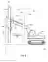 Fig. 09 - Lead alignment attachment
