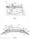 Fig. 02 - Sealing arrangement