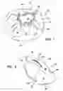 Fig. 02 - Boat propeller safety cover
