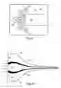 Fig. 03 - Microfluidic methods and apparatuses for sample preparation and analysis
