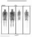 Fig. 17 - Therapy of malignant neoplasias