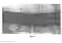 Fig. 07 - Engineered blood vessels