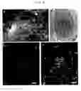 Fig. 04 - Hair growth method