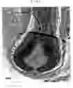 Fig. 07 - Hair growth method