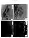 Fig. 09 - Hair growth method