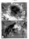 Fig. 12 - Hair growth method