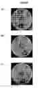 Fig. 06 - Phospholipase(s) and use(s) thereof