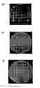 Fig. 07 - Phospholipase(s) and use(s) thereof
