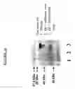 Fig. 23 - COMPOSITIONS COMPRISING ANTIBODIES TO HUMAN FGL2