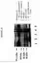 Fig. 25 - COMPOSITIONS COMPRISING ANTIBODIES TO HUMAN FGL2
