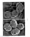 Fig. 04 - Surface proteins of Streptococcus pyogenes