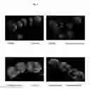 Fig. 05 - Surface proteins of Streptococcus pyogenes