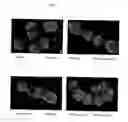 Fig. 06 - Surface proteins of Streptococcus pyogenes