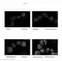 Fig. 07 - Surface proteins of Streptococcus pyogenes