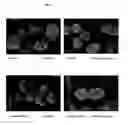 Fig. 08 - Surface proteins of Streptococcus pyogenes