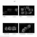 Fig. 09 - Surface proteins of Streptococcus pyogenes