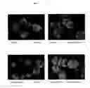 Fig. 10 - Surface proteins of Streptococcus pyogenes