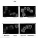 Fig. 11 - Surface proteins of Streptococcus pyogenes