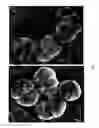 Fig. 04 - Surface proteins of Streptococcus pyogenes