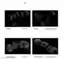 Fig. 05 - Surface proteins of Streptococcus pyogenes