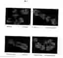 Fig. 06 - Surface proteins of Streptococcus pyogenes