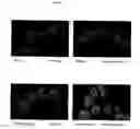 Fig. 07 - Surface proteins of Streptococcus pyogenes