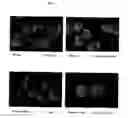 Fig. 08 - Surface proteins of Streptococcus pyogenes