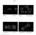 Fig. 09 - Surface proteins of Streptococcus pyogenes