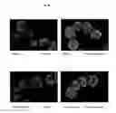 Fig. 11 - Surface proteins of Streptococcus pyogenes