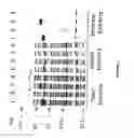 Fig. 04 - Strain of SARS-associated coronavirus and applications thereof