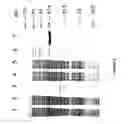 Fig. 06 - Strain of SARS-associated coronavirus and applications thereof