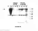 Fig. 96 - Strain of SARS-associated coronavirus and applications thereof