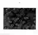 Fig. 03 - Surface proteins of Streptococcus pyogenes