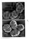 Fig. 04 - Surface proteins of Streptococcus pyogenes
