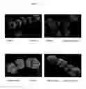 Fig. 05 - Surface proteins of Streptococcus pyogenes