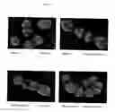 Fig. 06 - Surface proteins of Streptococcus pyogenes