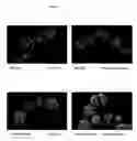 Fig. 07 - Surface proteins of Streptococcus pyogenes