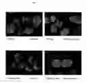 Fig. 08 - Surface proteins of Streptococcus pyogenes
