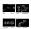 Fig. 09 - Surface proteins of Streptococcus pyogenes