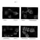 Fig. 10 - Surface proteins of Streptococcus pyogenes