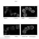 Fig. 11 - Surface proteins of Streptococcus pyogenes