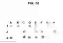 Fig. 14 - Surface proteins of Streptococcus pyogenes