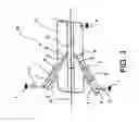 Fig. 04 - Method and device for continuously treating the surface of an elongate object