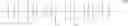 Fig. 03 - Cross-linkable composition for a battery electrolyte