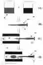 Fig. 01 - Implantable devices for chemonucleolysis of intervertebral discs