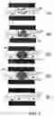 Fig. 06 - Implantable devices for chemonucleolysis of intervertebral discs