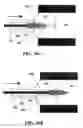 Fig. 22 - Implantable devices for chemonucleolysis of intervertebral discs
