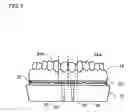 Fig. 02 - Working model suited for extraoral fabrication